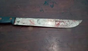 Adolescente de 13 años hiere a compañera de escuela porque se burlaba de ella