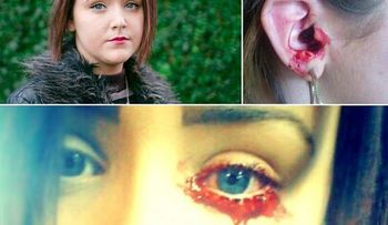 Una joven sangra por los ojos y oídos y nadie sabe la razón