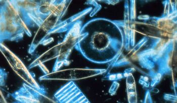 Desarrollaron alga que mata 90% células cancerígenas sin dañar las sanas