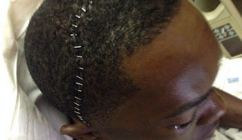 Video: Aroldis Chapman recibe pelotazo en la cara