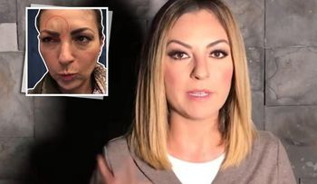 Mariana Ochoa comparte su experiencia con el uso de botox