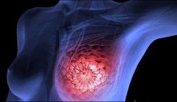 Científicos descubren otra posible forma de tratar y prevenir el cáncer 