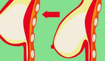 3 trucos que le devolverán la forma a tus senos: ¡Remedio efectivo y saludable!