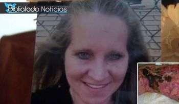 Mujer muere luego de contraer el virus "Come Carne en una playa de EE.UU