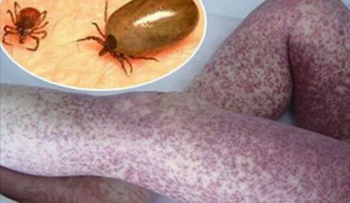 Si duermes con tu mascota, tu salud y la de tus hijos están en peligro, te decimos por qué â?¦