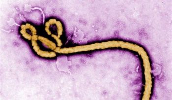 Detectan ébola en el ojo de un paciente curado 