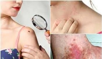 Señales de que tiene un cáncer: Presta mucha ATENCION 