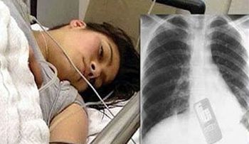 Joven se traga celular para que novio no leyera sus mensajes 