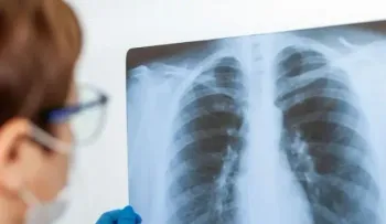 Consejos para la prevención de la neumonía