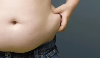 El 70% de personas con obesidad en Latinoamérica no están diagnosticadas