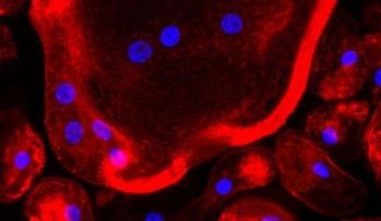Encuentran la clave para prevenir la metástasis del cáncer de mama