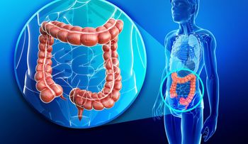 Cáncer colorrectal va en aumento y causa 112.000 muertes al año en América 