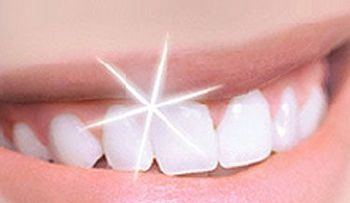 Cosas que debes saber antes de blanquear tus dientes