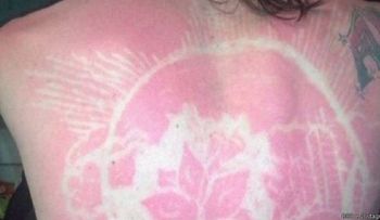 La peligrosa moda de los tatuajes que alarma a los dermatólogos