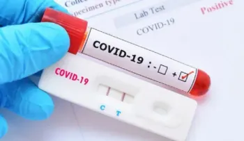 Gobierno y farmacias colaboran para liberar venta de pruebas Covid