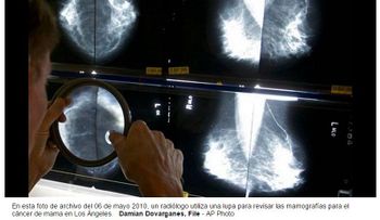 Estudio muestra ventaja de tratamiento para cáncer de mama 