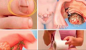 Las 13 señales que te avisan de un cáncer