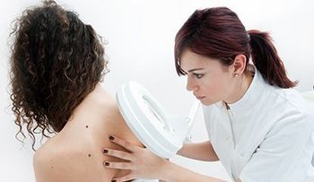Los lunares podrían ayudar a predecir el riesgo de cáncer de mama