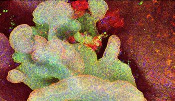 Los científicos observan por primera vez cómo nace el cáncer de piel