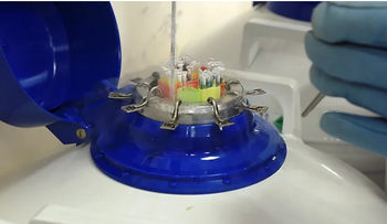 Caso del donante 7069: 200 hijos y un gen cancerígeno