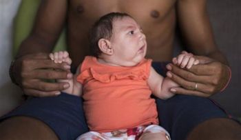Nace en Hawaii un bebé con el virus zika