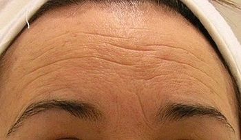 Crema casera para eliminar arrugas en solo 7 días: ¡A lucir más joven y bella!