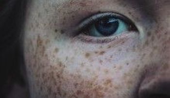 Revolucionario método para suavisar las pecas y manchas de las manos