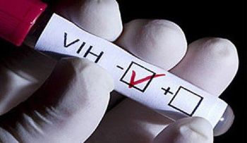 Científicos optimistas en hallar la cura del VIH gracias a nuevas investigacion