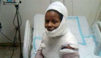 Mujer quemada junto a hijos abandona hospital Luis E.Aybar porque â??no la atendíanâ?