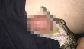 Una foto de Cocodrilo mordiendo genitales a un hombre se viraliza; podría tener una bacteria 