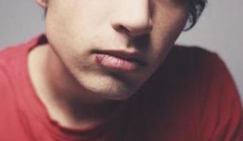 Remedios para evitar el herpes labial