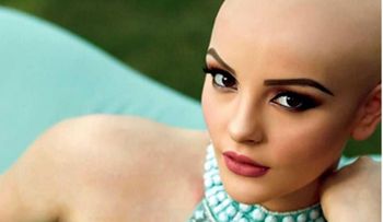 La modelo mexicana que convirtió su lucha contra el cáncer en una fuente de inspiración