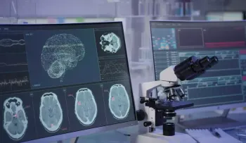 Descubren una proteína (CPEB4) implicada en el desarrollo de la esquizofrenia