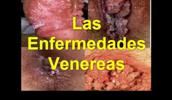 Síntomas de enfermedades venéreas (VIDEO)