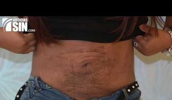 Centro de estética era el camino a la muerte: Así quedaron estas mujeres y un hombre