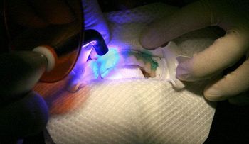 Unas encías enfermas aumentan la posibilidad de sufrir infarto, diabetes o parto prematuro  