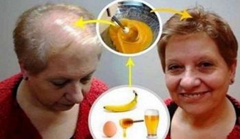 Doctores con la boca abierta con esta receta para crecer el cabello