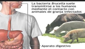 La brucelosis: Enfermedad bacteriana que se transmite al ser humano por animales 