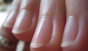 Comerse las uñas perjudica seriamente la salud 