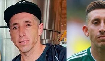 Héctor Herrera y los despiadados memes por su cambio de rostro por cirugías estéticas