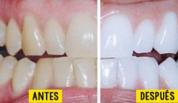 Mezcló estos tres ingredientes y los colocó en sus dientesâ?¦ No podrás creer los resultados