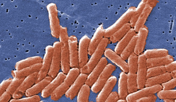 Identifican causante de muerte a millones de personas en epidemia misteriosa en Guatemala, México y Perú