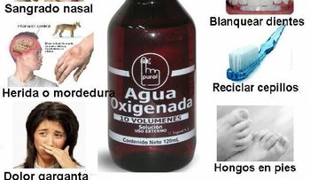 10 remedios con agua oxigenada