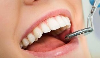 ¿Quistes bucales? Conoce esta patología silente y muy común 