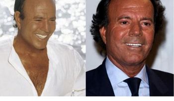 Algunos personajes famosos con pelo implantado y otros que usan peluca