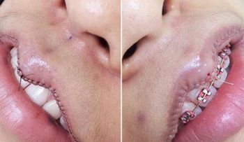 Una FUERTE tendencia de belleza que genera revuelo. ¿Usted harías esto? 