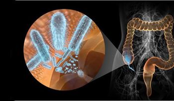  Microbios intestinales pueden influir en desarrollo de esclerosis múltiple 
