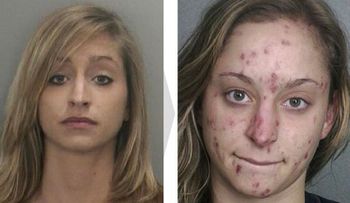 Efectos desgarradores de las drogas: ANTES Y DESPUES. Te pasaría lo mismo
