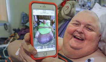 Le extirparon un tumor de casa 60 kilos que tenía hace más de una década