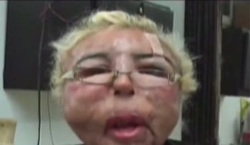 Video: para lucir un rostro joven.